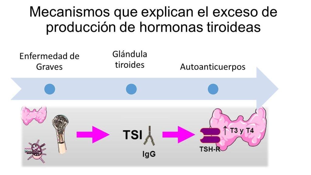 Hipertiroidismo